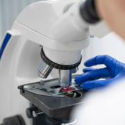 La biopsia invasiva pronto podría no ser necesaria para diagnosticar la enfermedad celiaca